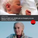 Cuando nace un bebé con cabello de Targaryen